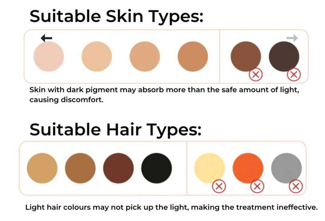 LUX SKIN IPL HAIR REMOVAL - photo 4