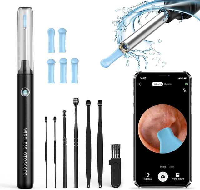 Wireless Otoscope Kit – Bluetooth & Camera | BNIB | $25 thumbnail