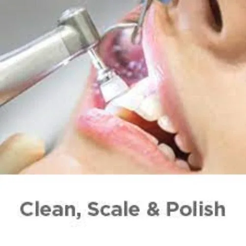 EZ Dental Prophy Brush, Disposable, Low-speed, White /100Pcs image indicator(4)