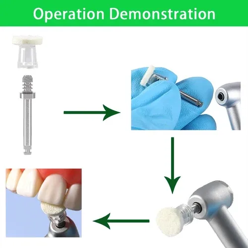 EZ Smile Dental Polisher Finishing Wheel Kit image indicator(3)