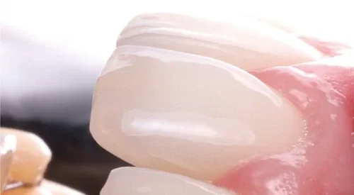 Ez Smile Dental Jewelry Polisher Silicon Carbide Brushes image indicator(7)