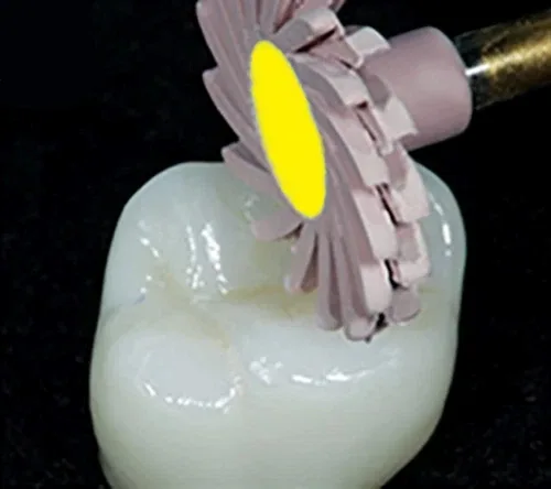 EZ Dental Ceramic Polishing Finishing Rubber Wheels Spiral Kit image indicator(3)