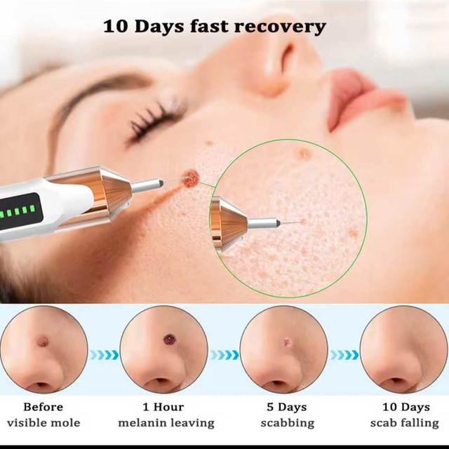 BEAUTY PEN, Spot Removal Pen - photo 4