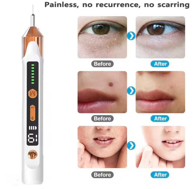 BEAUTY PEN, Spot Removal Pen - photo 5