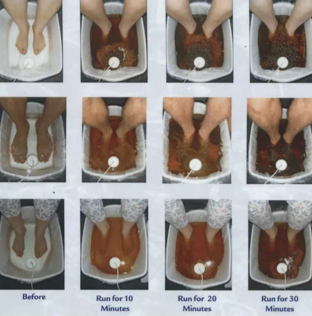 Healifeco Ionic Foot Spa - photo 3