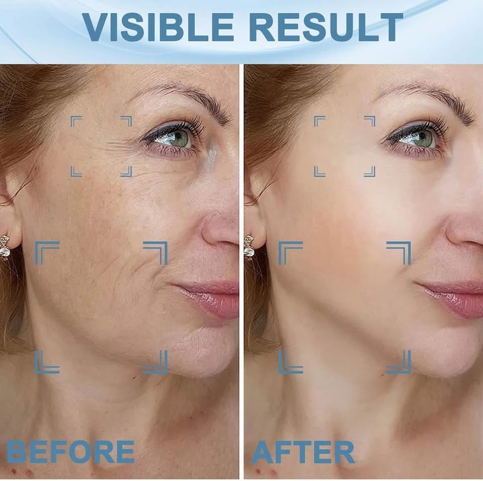 Red Light Therapy Device for Face and Neck Facial Mass - photo 4