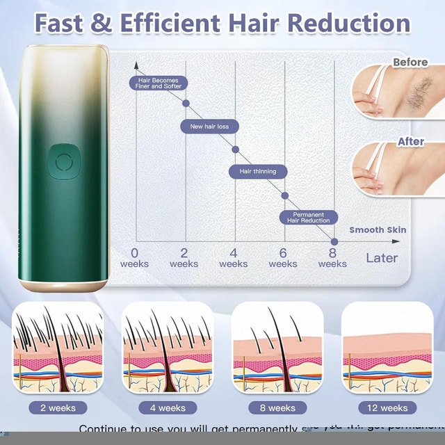 Ice Cooling Hair Remover for Women and Men BNIB - photo 5