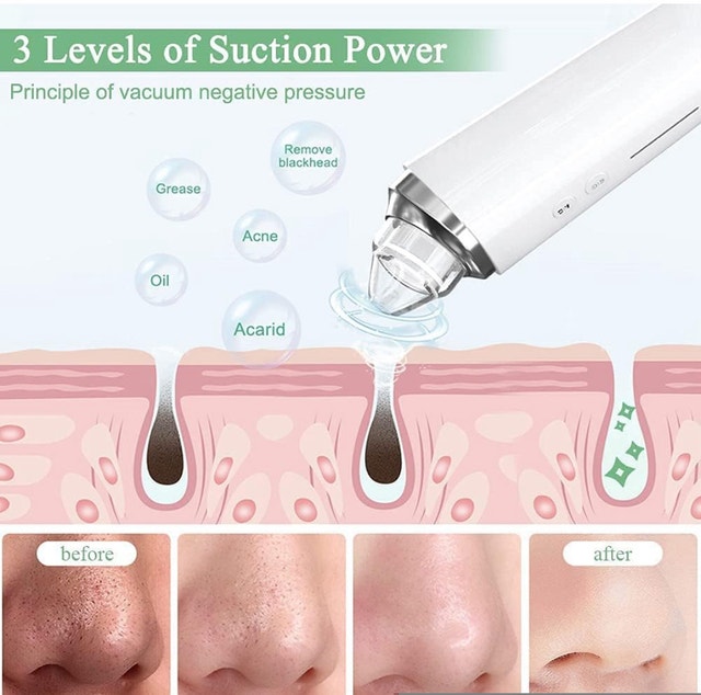 Blackhead Remover! Green - photo 4