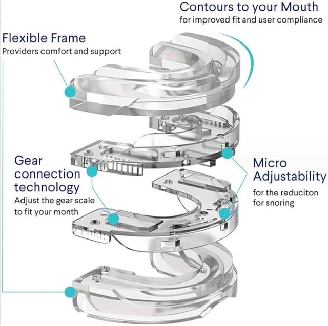 Stop Snoring Devices – Anti Snoring Mouth Guard - photo 5