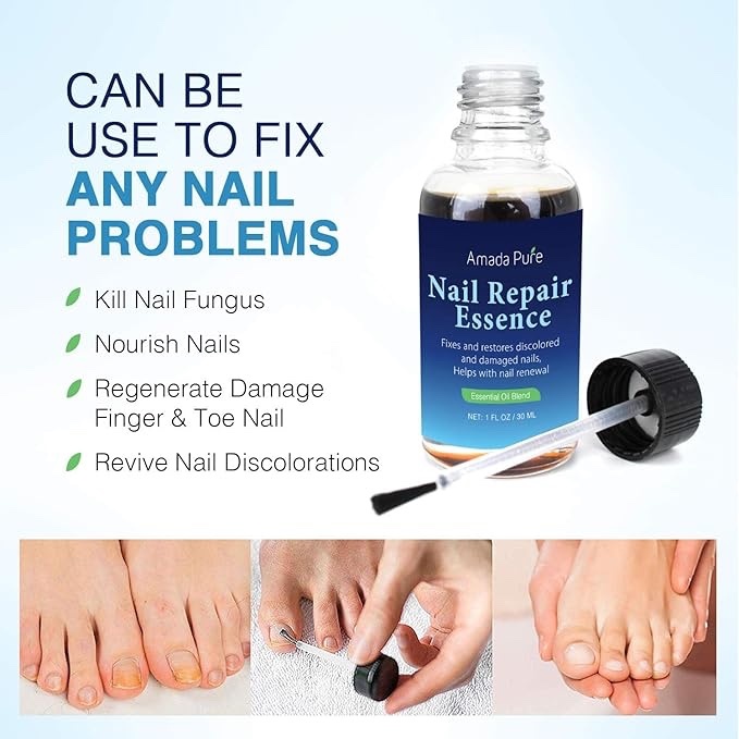 Beautiful Healthy Nails In A Few Weeks! - photo 3