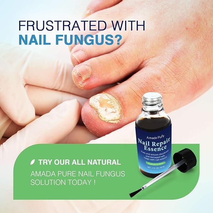 Beautiful Healthy Nails In A Few Weeks! - photo 4