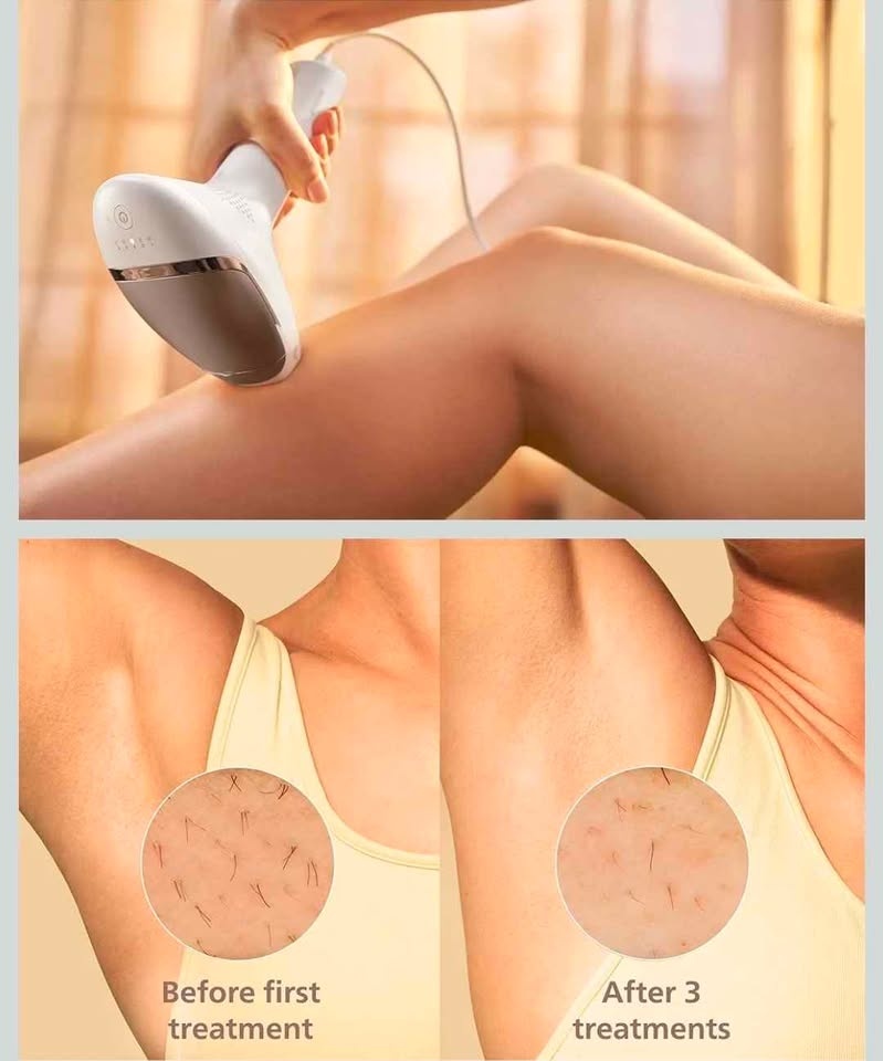 Philips Lumea 9000 Series IPL Hair Removal Device - photo 5