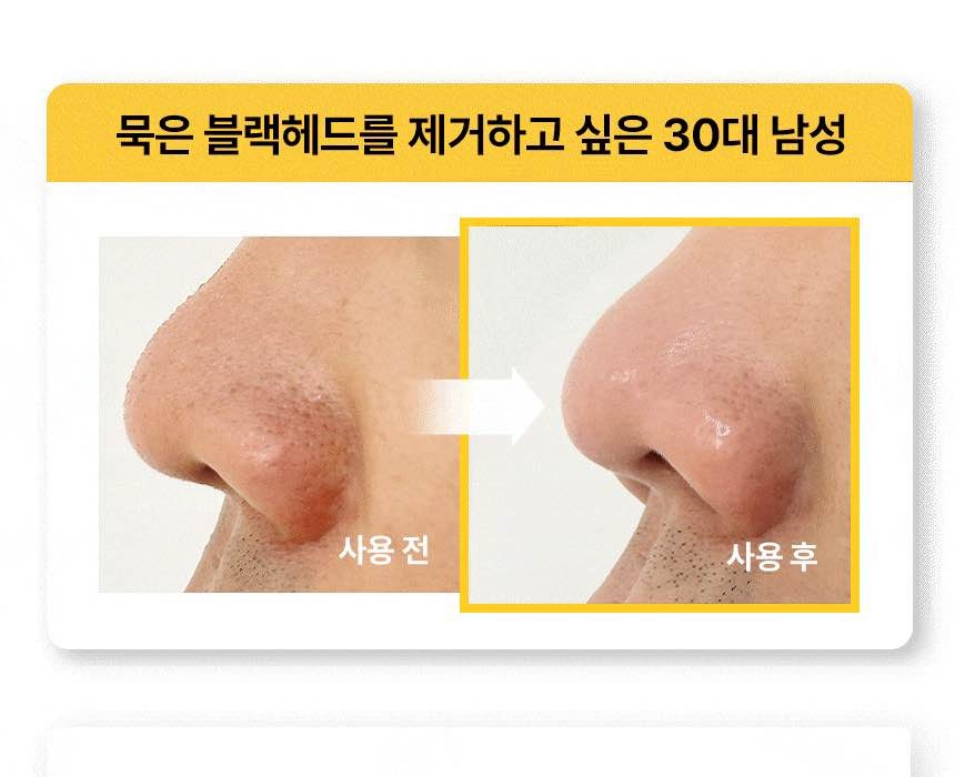Honey Glove Pore Strips - The Tool Lab (Korean Skincare) - photo 4