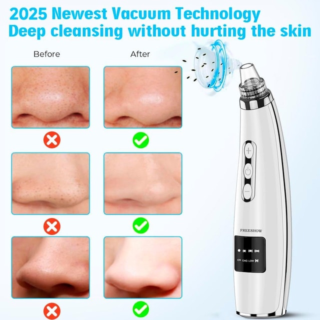 Pore Blackhead Remover Vacuum + Steel Tool Kit - photo 4