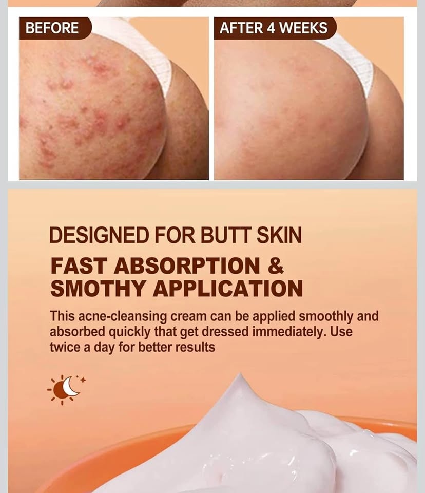 Butt Acne Cream