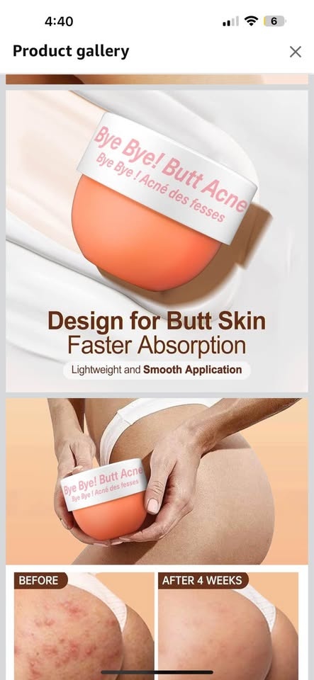 Butt Acne Cream - photo 3