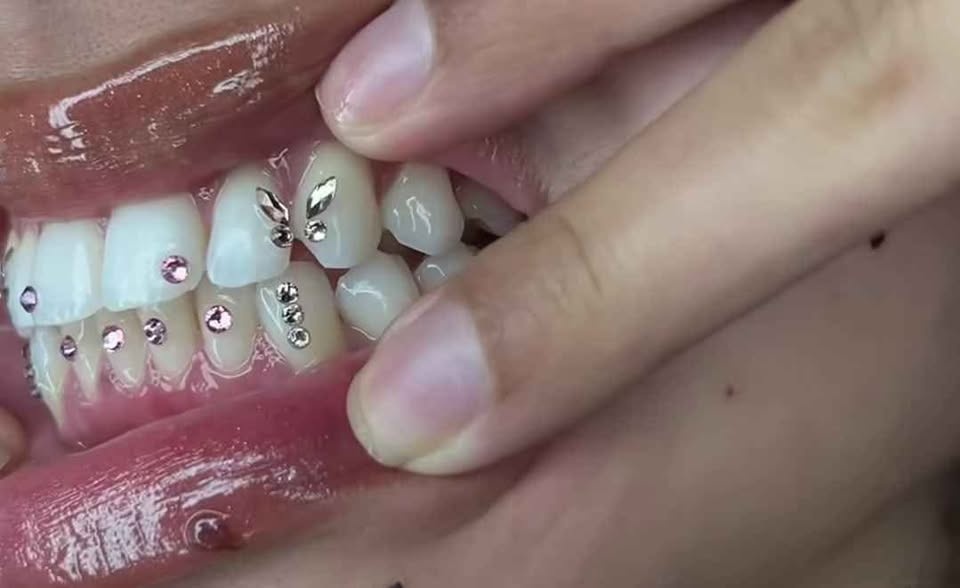 TOOTH GEMS/WHITENING - MOBILE SERV.