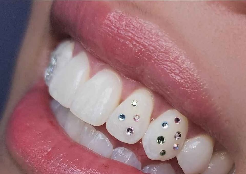 TOOTH GEMS/WHITENING - MOBILE SERV. - photo 2