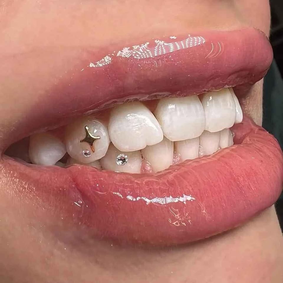 TOOTH GEMS/WHITENING - MOBILE SERV. - photo 3