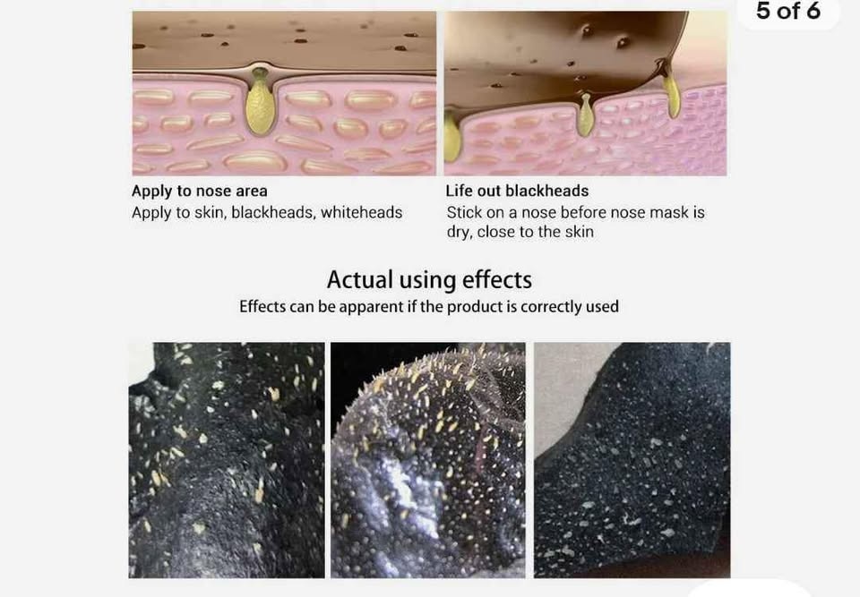 Black Head Remover Mask - photo 3