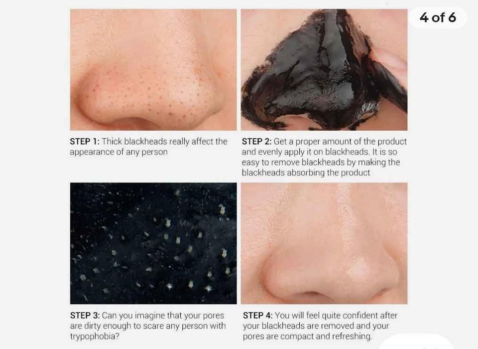 Black Head Remover Mask - photo 4