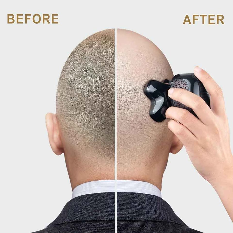 Magnetic Head Shaver for Bald Men - photo 5
