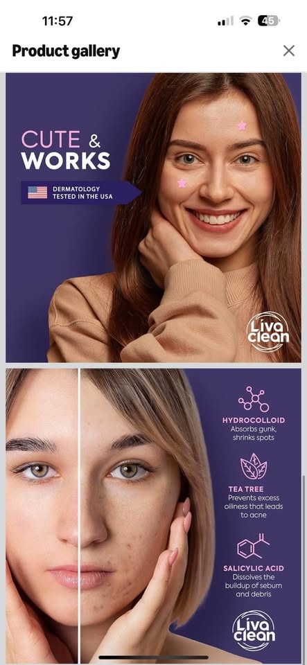 Superstar Pimple Patches - 240 Count - photo 4