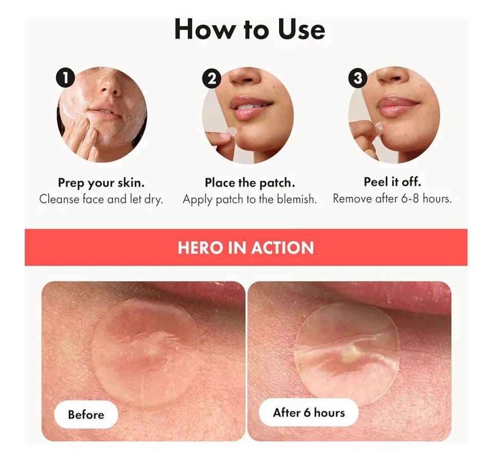 Hero Cosmetics Mighty Patch Original - 72ct Pimple Patches - photo 3