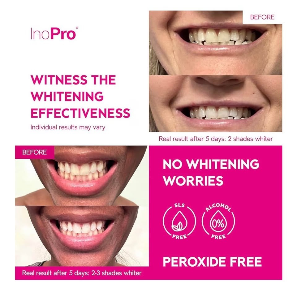 InoPro Teeth Whitening Strips 21 Treatments Kit - photo 2