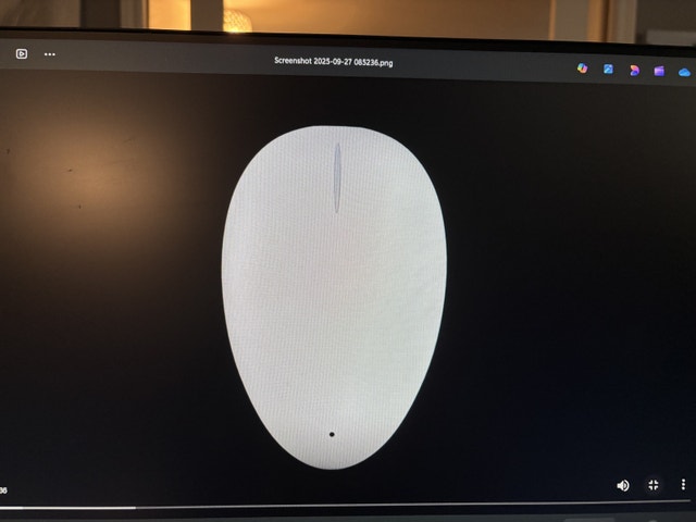 Smart Nora - Snoring Solution - photo 3