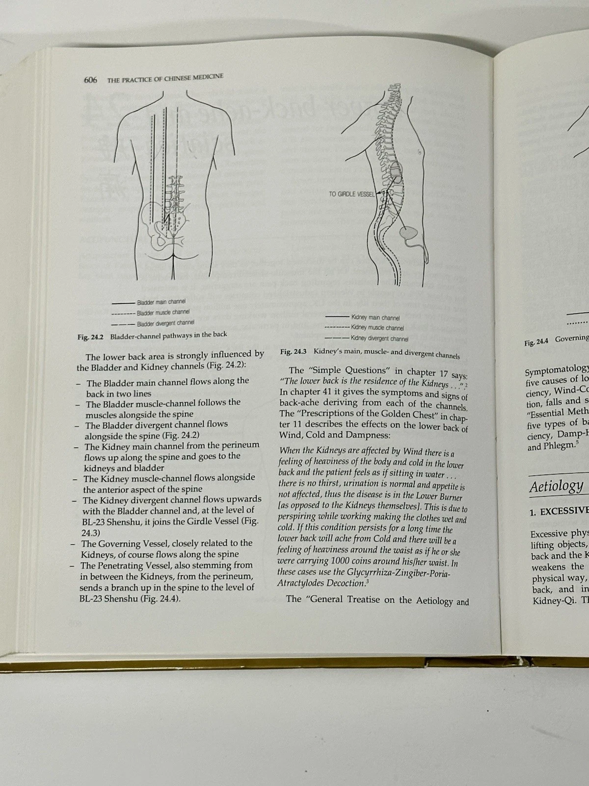 The Practice of Chinese Medicine Maciocia Acupuncture Herbs Hard - photo 4