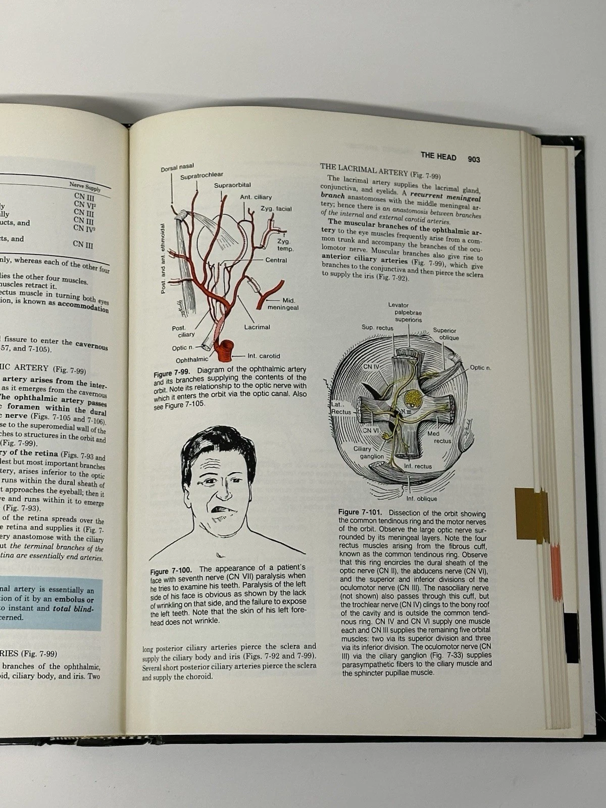 Clinically Oriented Anatomy 2nd Edition Keith L Moore Hardcover - photo 5