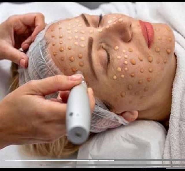 Bb Glow Facial Treatment for women - photo 2