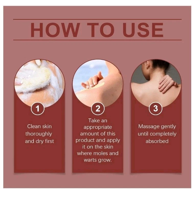 Bee Venom Skin Tag Removal Cream - photo 4