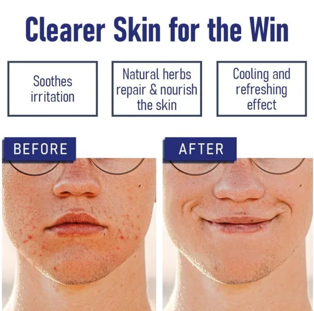 Bump Eraser After Shave Ingrown Hair Treatment image indicator(3)