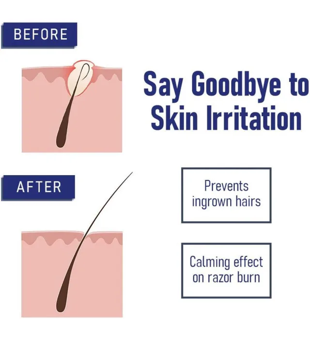 Bump Eraser After Shave Ingrown Hair Treatment image indicator(4)