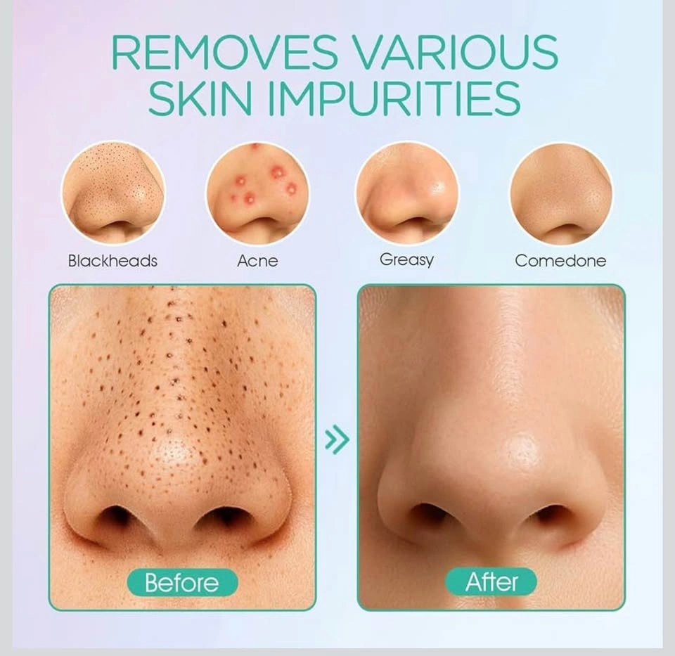 (New) Blackhead Remover - photo 3