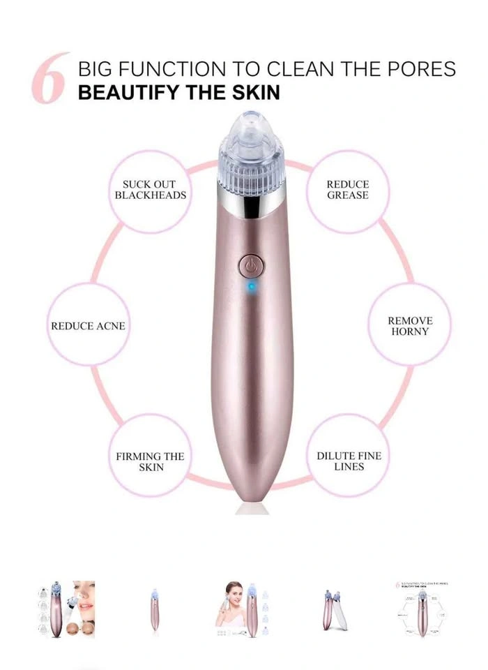 Vacuum Cleaner-XN 8030 Blackhead Remover - photo 2