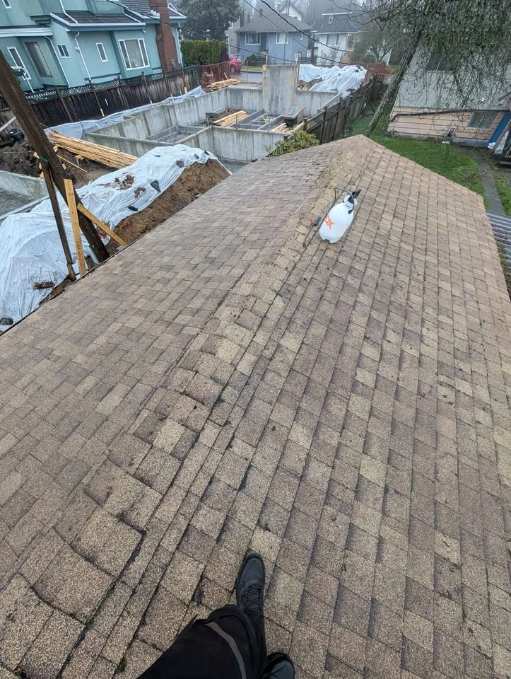 Shingles - photo 3