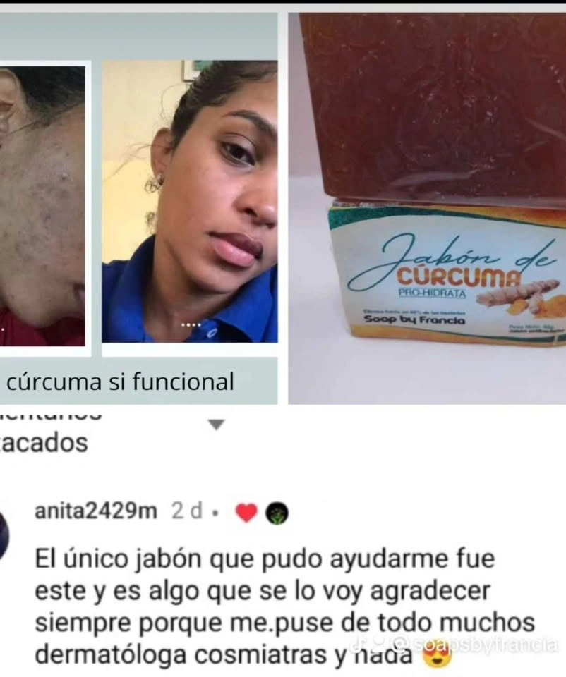 Turmeric Soap for Dark Spots