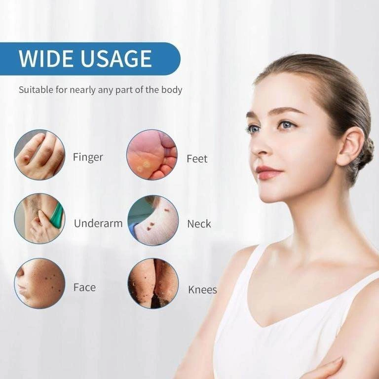 Dual-TROL Skin Tag Removal Kit - photo 2