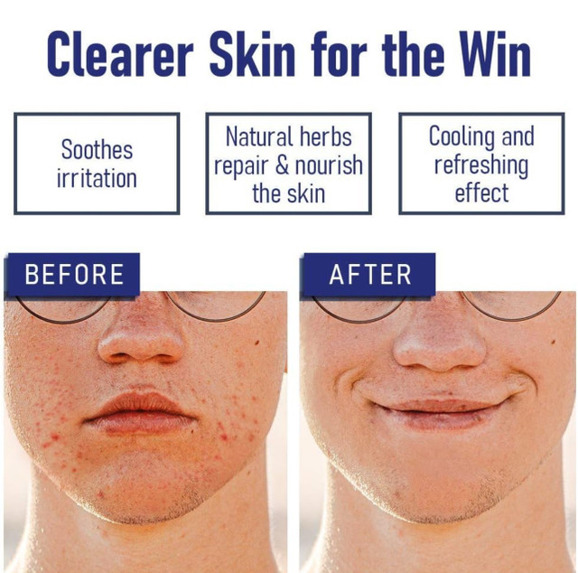 Bump Eraser After Shave Ingrown Hair Treatment - photo 3