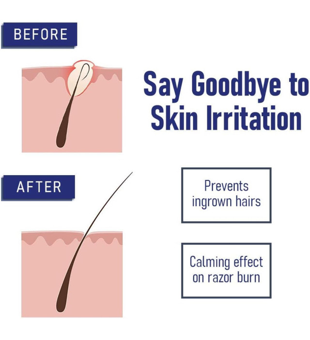 Bump Eraser After Shave Ingrown Hair Treatment - photo 4