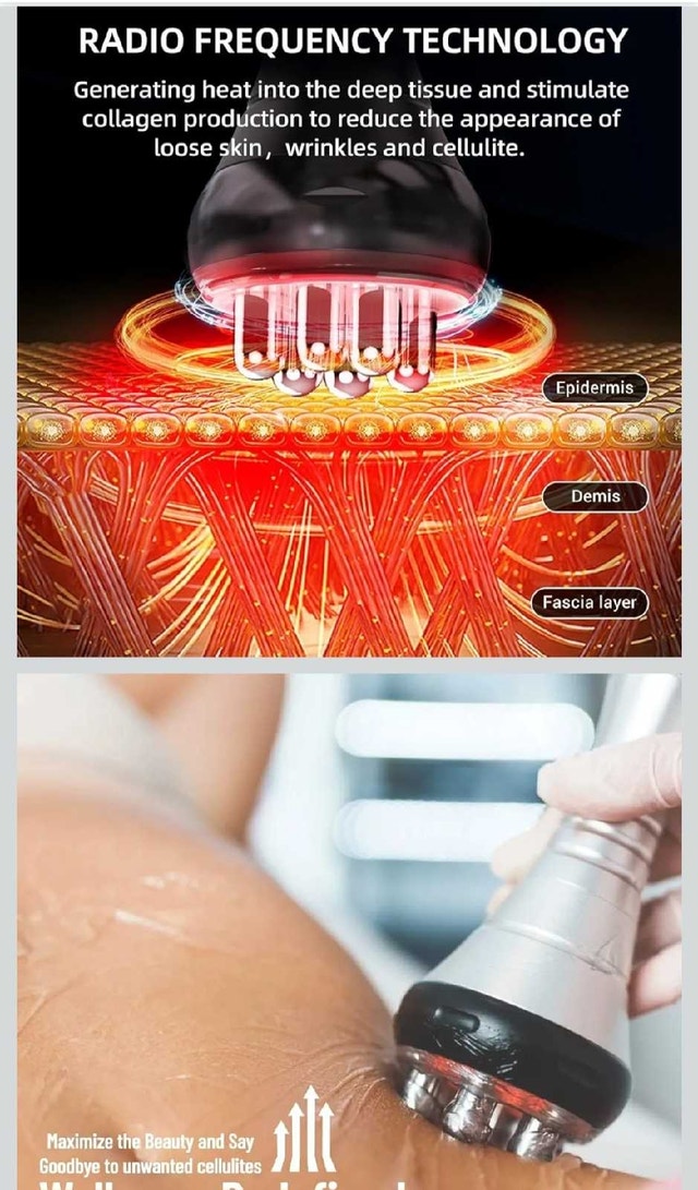 Kim8 Slimming System - Cavitation, RF, Laser - photo 5