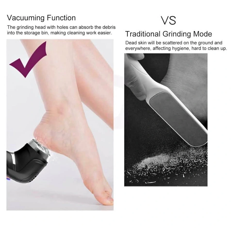 Electric Foot Callus Remover Kit (PICKERING)