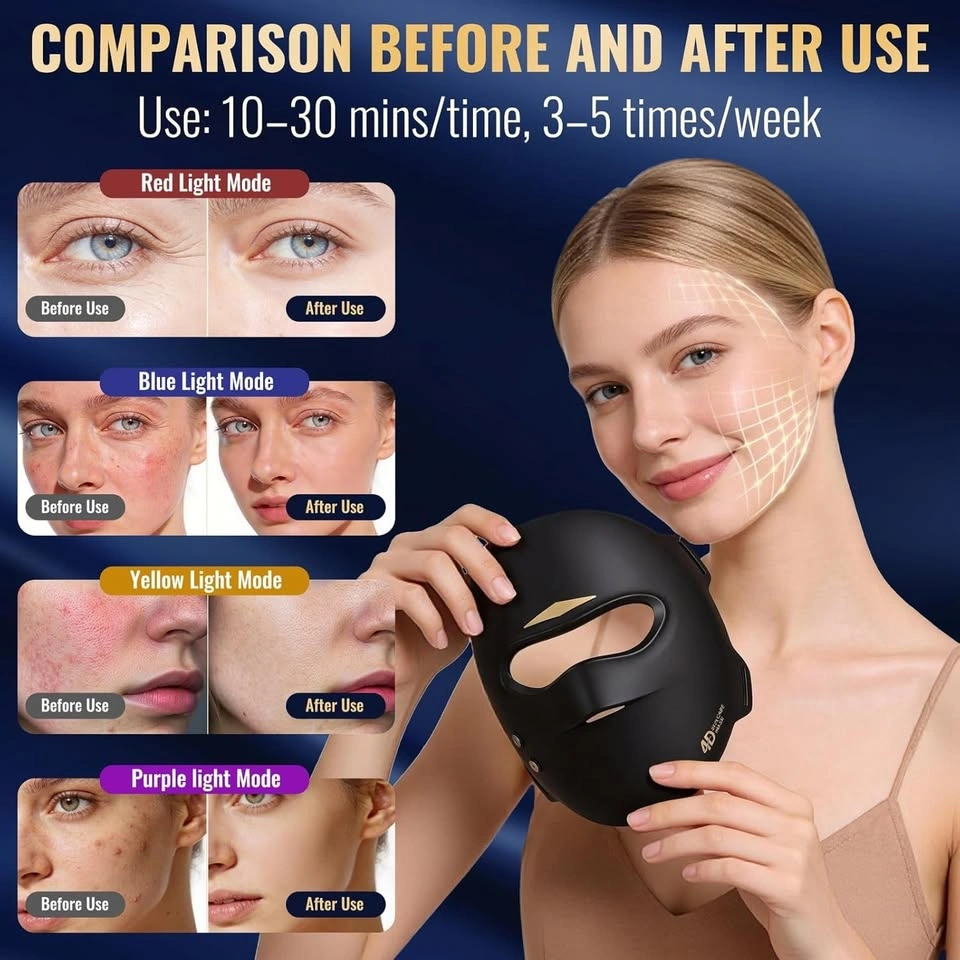 Cordless LED Facial Beauty Mask - Cash Only - photo 3