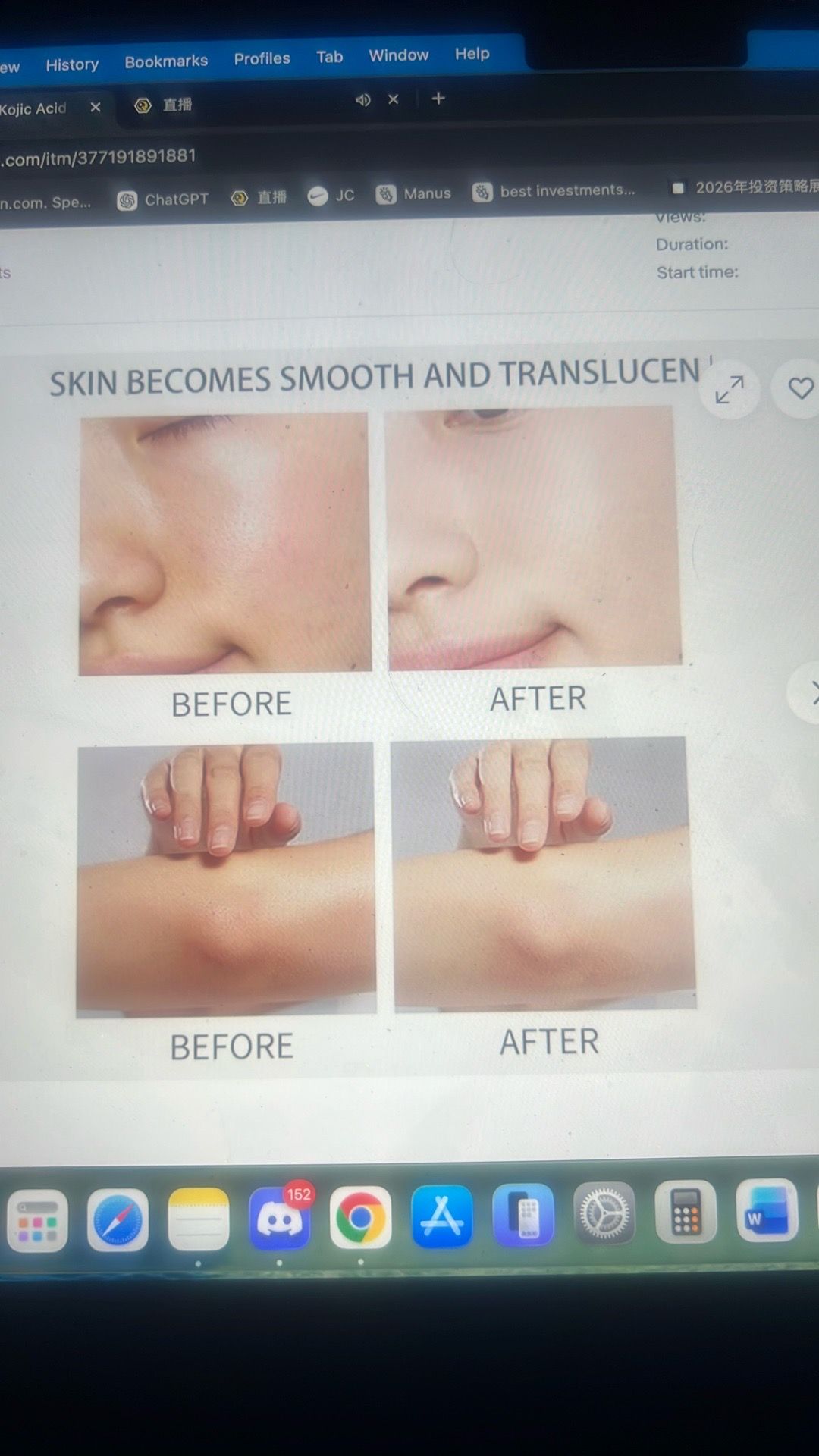 Body keratin care kojic acid turmeric spray - photo 4
