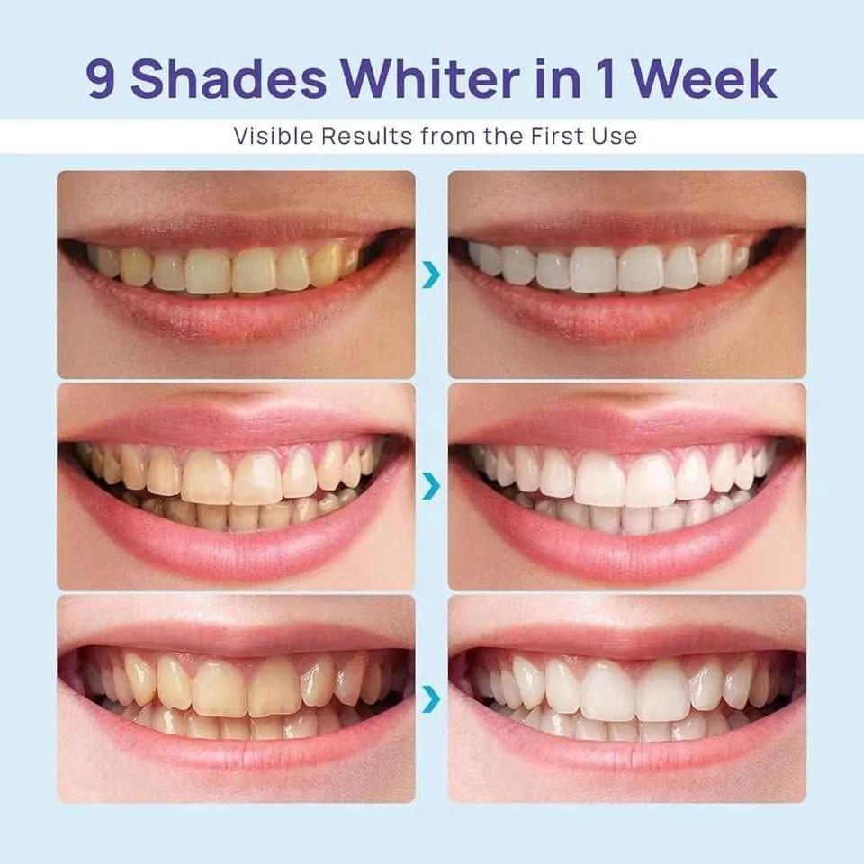 Whitebite Pro Teeth Whitening Kit, LED Light, Mouth Tray - photo 2