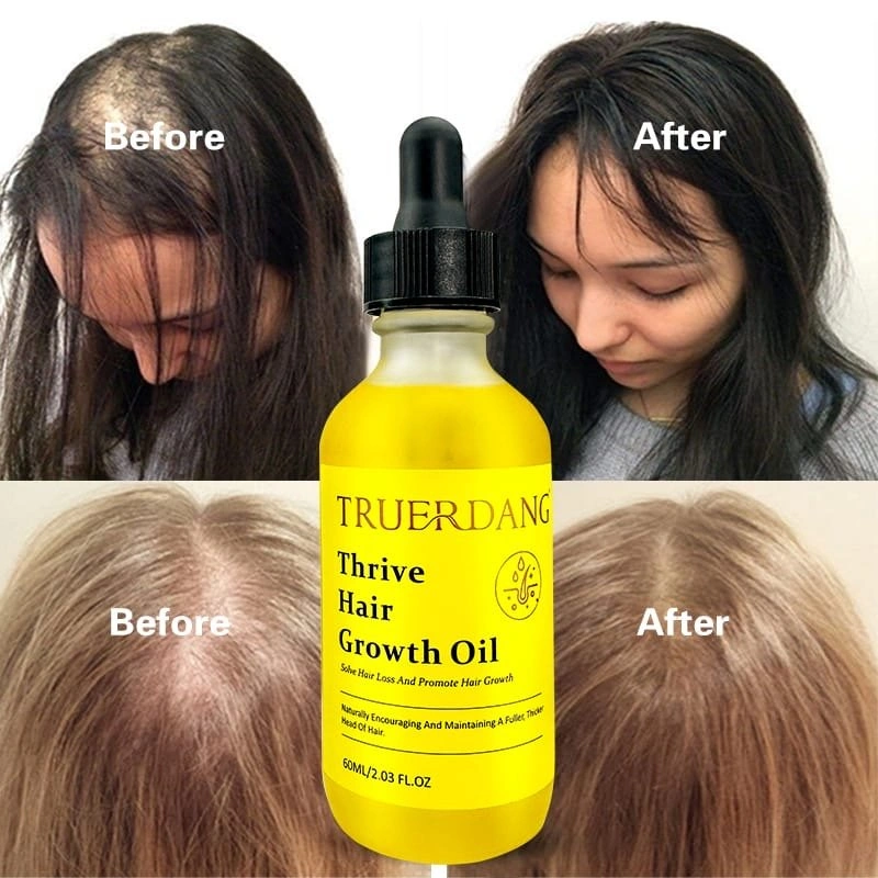 Rosemary Natural Herbal Hair Growth & Scalp Nourishing Oil 60ml - photo 3