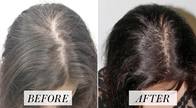 Hair Loss Solution thumbnail